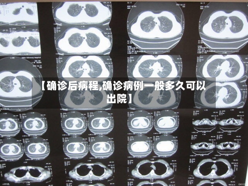 【确诊后病程,确诊病例一般多久可以出院】-第2张图片