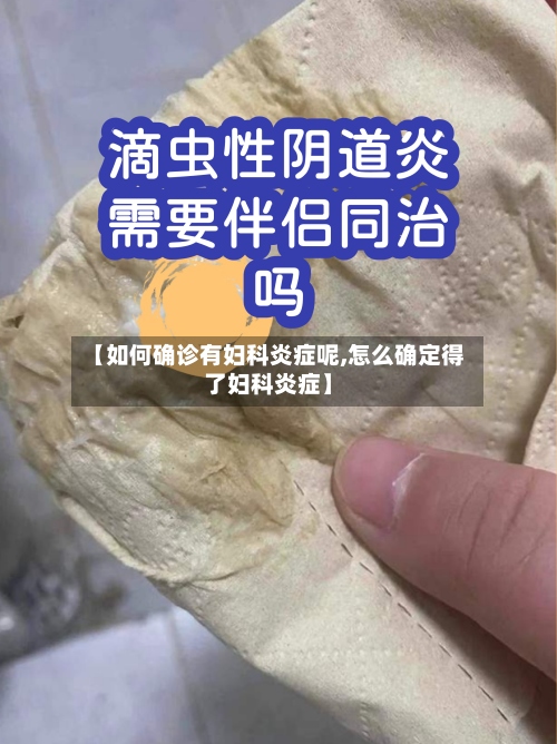 【如何确诊有妇科炎症呢,怎么确定得了妇科炎症】-第3张图片