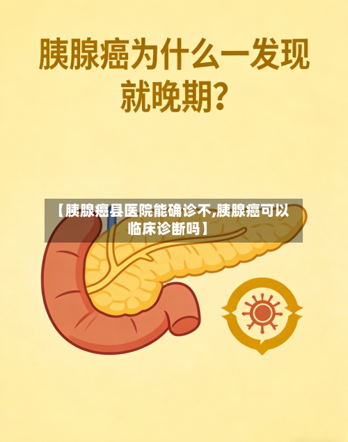 【胰腺癌县医院能确诊不,胰腺癌可以临床诊断吗】