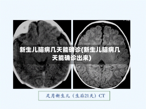 新生儿脑病几天能确诊(新生儿脑病几天能确诊出来)-第3张图片
