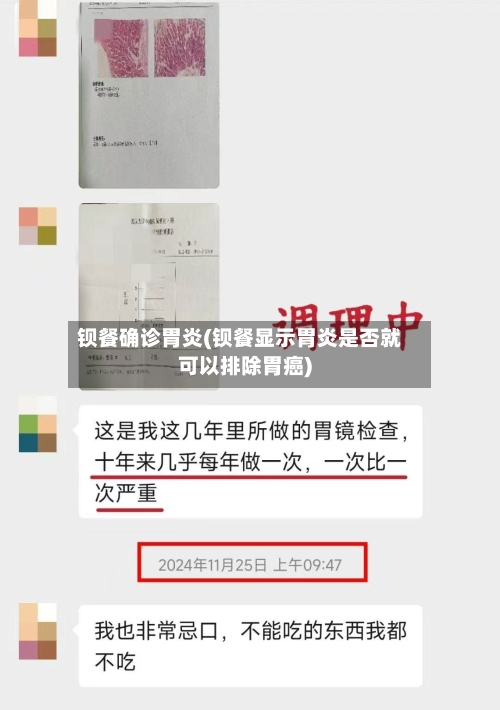 钡餐确诊胃炎(钡餐显示胃炎是否就可以排除胃癌)-第2张图片