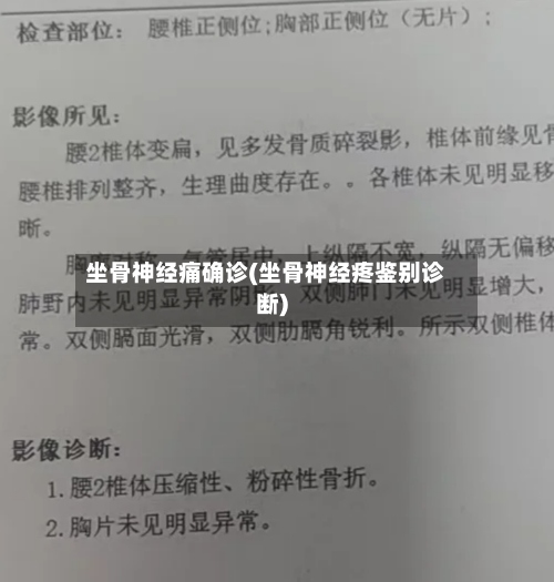 坐骨神经痛确诊(坐骨神经疼鉴别诊断)