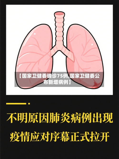 【国家卫健委确诊75例,国家卫健委公布新增病例】-第3张图片