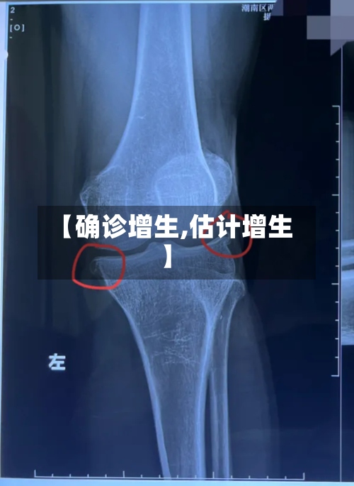 【确诊增生,估计增生】-第2张图片