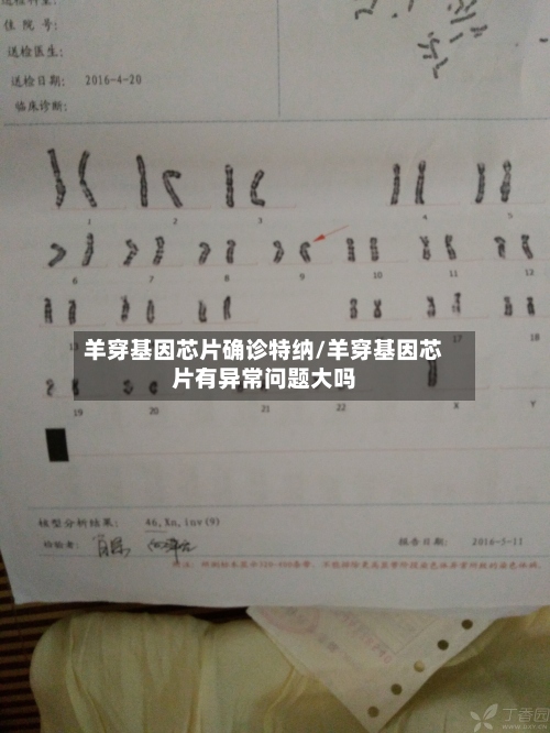 羊穿基因芯片确诊特纳/羊穿基因芯片有异常问题大吗