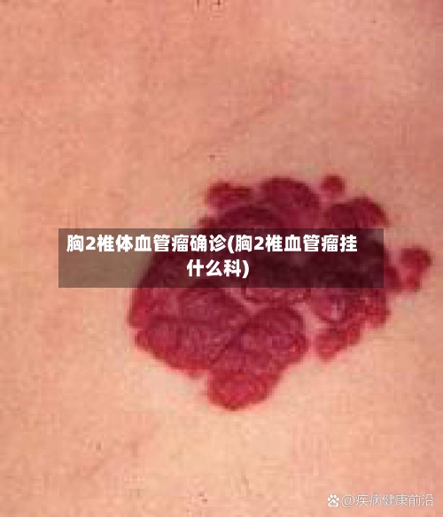 胸2椎体血管瘤确诊(胸2椎血管瘤挂什么科)
