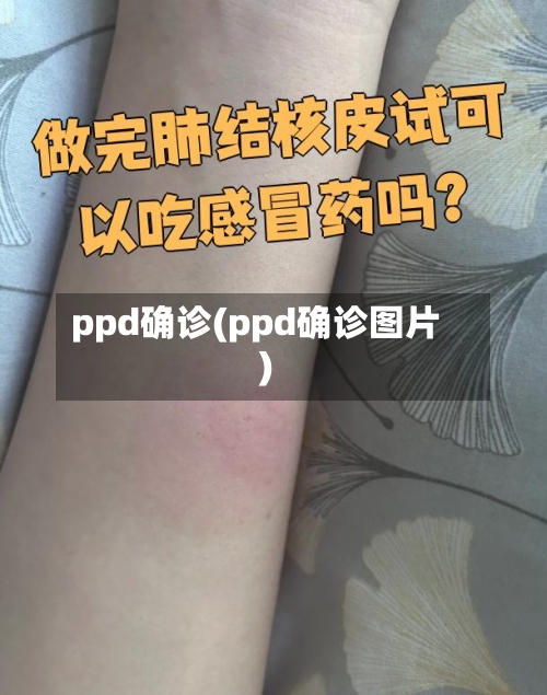 ppd确诊(ppd确诊图片)-第3张图片