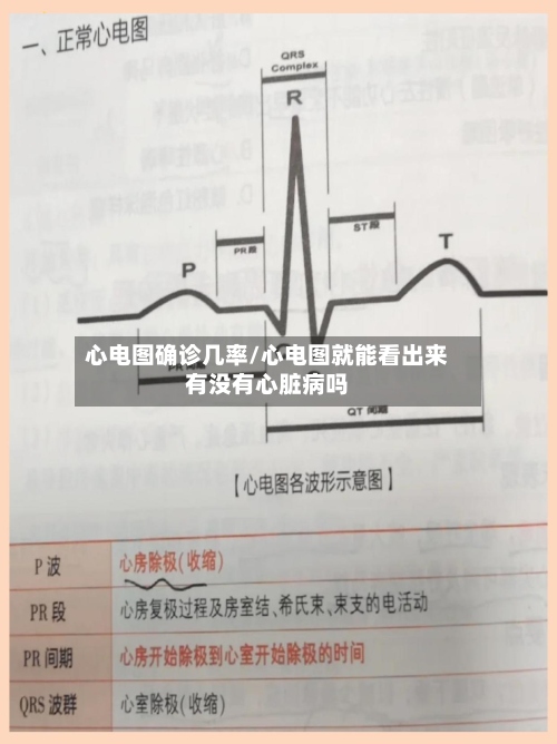 心电图确诊几率/心电图就能看出来有没有心脏病吗-第2张图片