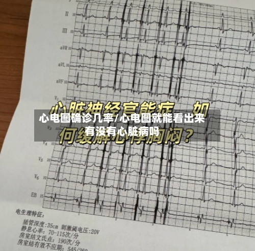 心电图确诊几率/心电图就能看出来有没有心脏病吗