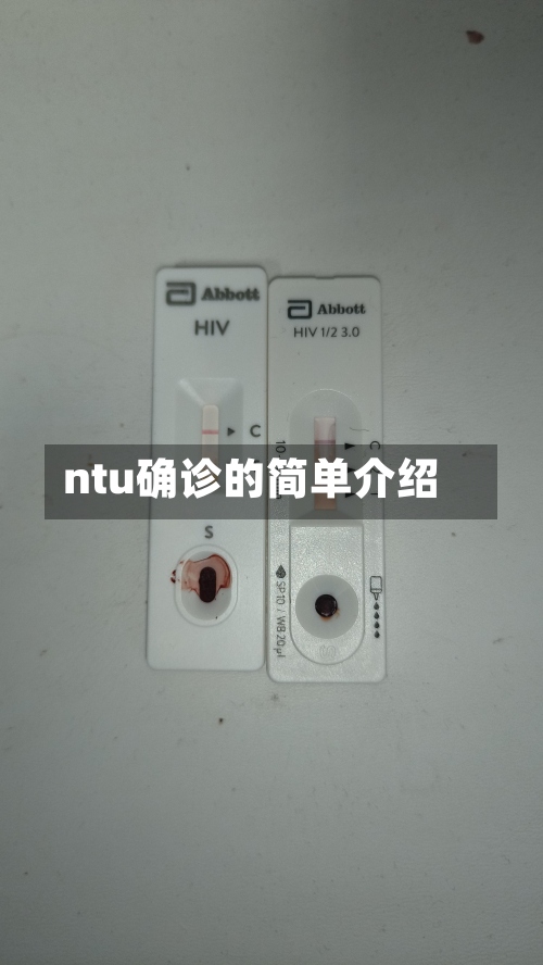 ntu确诊的简单介绍-第3张图片