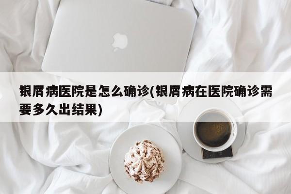 银屑病医院是怎么确诊(银屑病在医院确诊需要多久出结果)